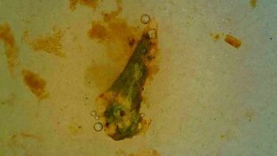 Poules, coproscopies et examens au microscope -2/2