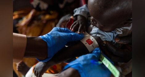 Alerte de l'OMS au Soudan : 1200 enfants morts de malnutrition et de rougeole... 