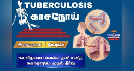 காசநோய் Tuberculosis
