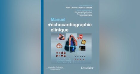 [échocardiographie]: Manuel d'échocardiographie clinique pdf gratuit 