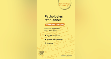 [ophtalmologie]:  Pathologies rétiniennes : 100 études cliniques pdf gratuit 