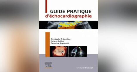 [échocardiographie]: 2021:Guide pratique d'échocardiographie 2021 pdf gratuit 