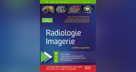 [imagerie]:MED-LINE Radiologie Imagerie – 4e édition augmentée – R2C PDF
